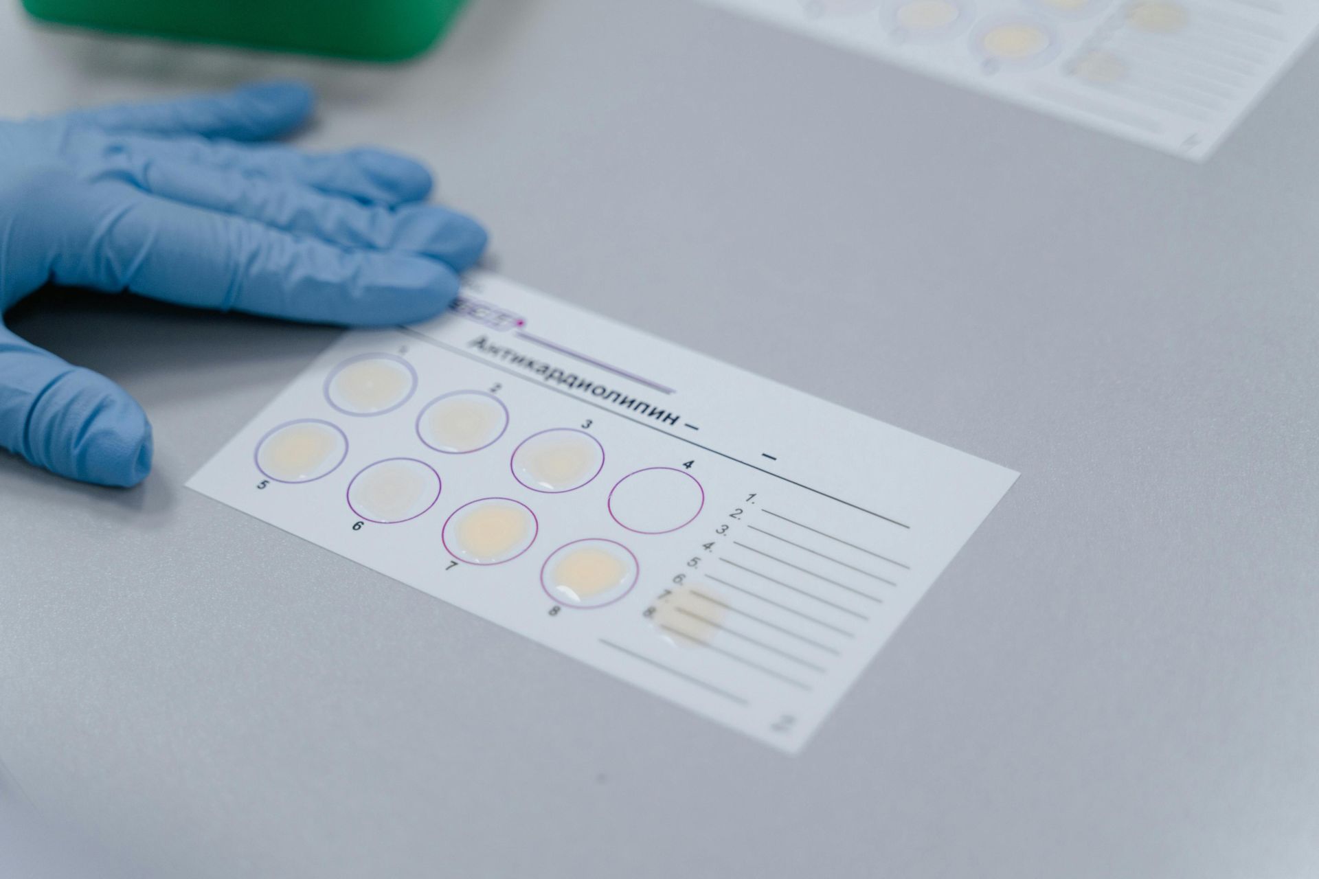 Lab test result form with gloved hand, indicating a scientific experiment setup.